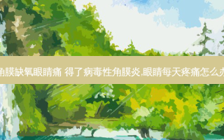 角膜缺氧眼睛痛 得了病毒性角膜炎,眼睛每天疼痛怎么办